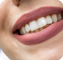 نمونه کارهای ایمپلنت دندان